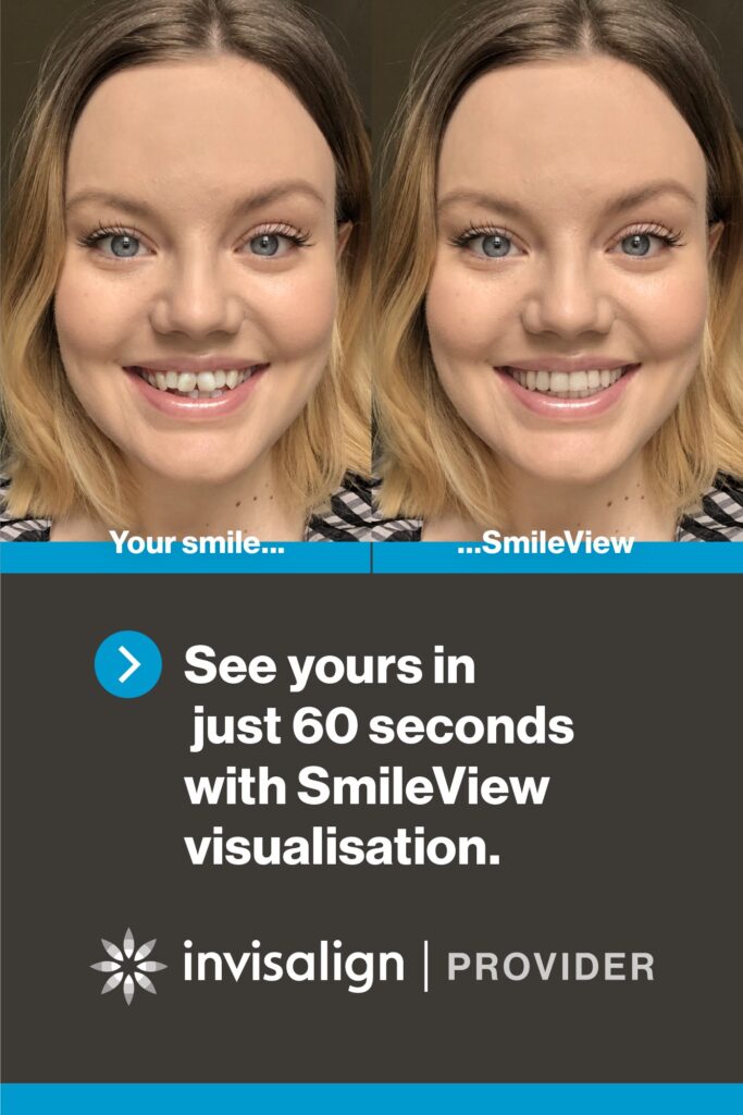 Invisalign - Onzichtbare beugel voor en na met SmileView - Clinias Tandartspraktijken